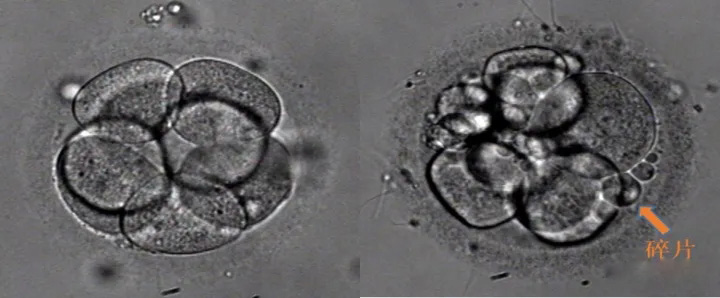8细胞胚胎