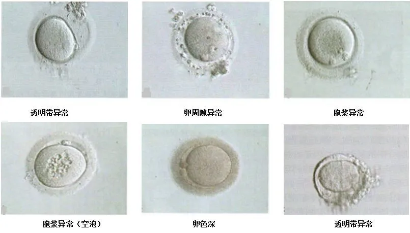 卵细胞大小标准参照表一览，有生育需求的可对着看